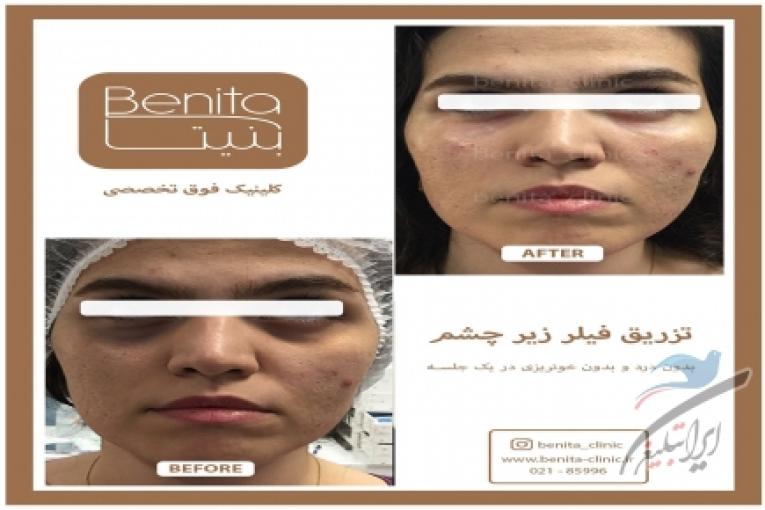 قیمت لاغری با ترواسکالپ